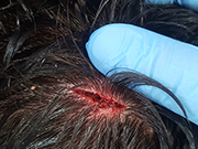 Herida fiestas encierro